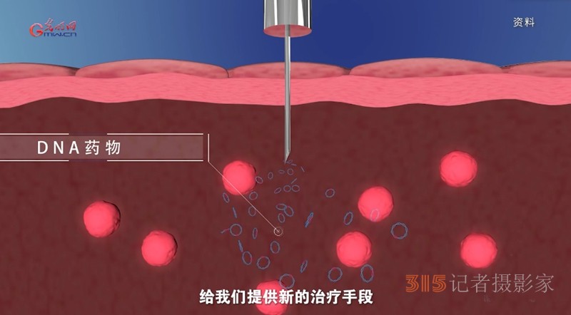 宮頸癌消滅戰(zhàn)：如何減少“梅艷芳式悲劇”？